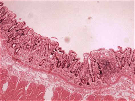 Colon Histology