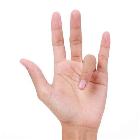 Trigger Finger Stenosing Tenosynovitis 2 The Orthopedic And Sports
