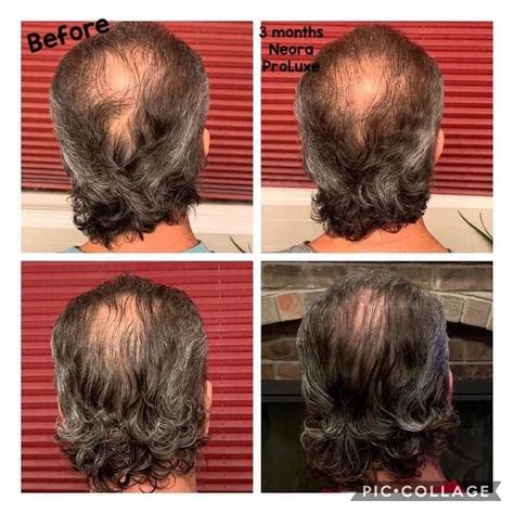 Here are some of the factors to be considered to ensure a smooth experience of hair highlighting at home: Pin on Haircare
