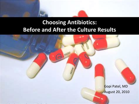 Ppt Choosing Antibiotics Before And After The Culture Results