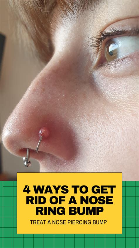 4 Things To Treat Infected Nose Piercing Bump Without Closing It In
