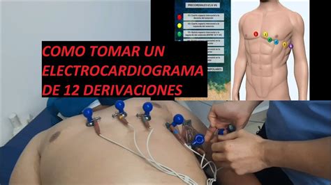 Síntesis de artículos como se hace un electrocardiograma actualizado recientemente