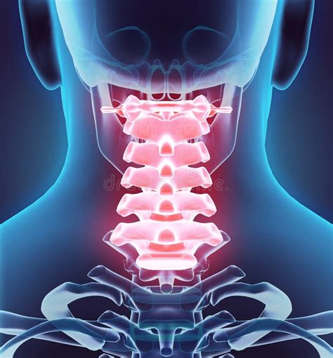 3d Illustration Of Cervical Spine Medical Concept Stock Illustration