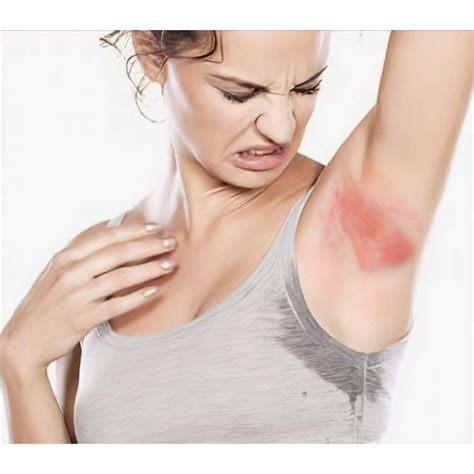 Yellow Armpit Skin 4 Types Of Fungal Skin Infections That Cause Yellowing Of The Armpit