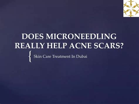 Ppt Does Microneedling Really Help Acne Scars Powerpoint Presentation