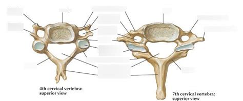 Bone Quiz 1 - Cervical Vertebrae 1 Diagram | Quizlet