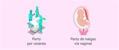 Bebé En Posición Podálica ¿qué Significa Y Qué Hacer Para Cambiarla