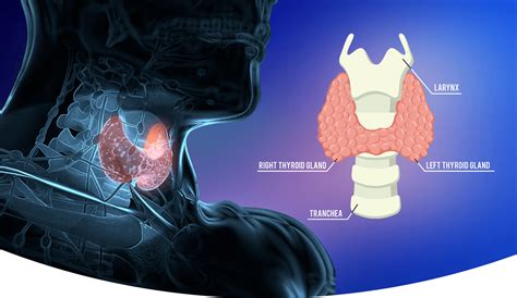 Thyroid And Parathyroid Surgery By Dr Pradeep Chowbey