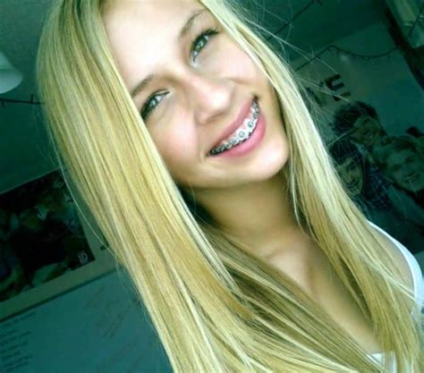 Madison S Girls With Braces On Tumblr Submit Via Page