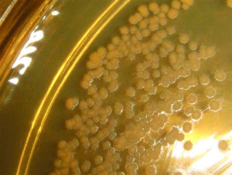Nutrient Agar Plate Showing Growth Of Nocardia Asteroides Download