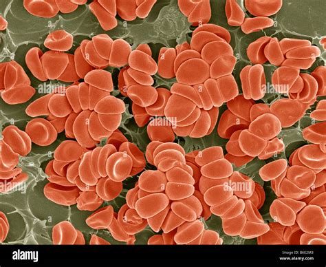 Blood Clot Coloured Scanning Electron Micrograph Sem Of Red Blood