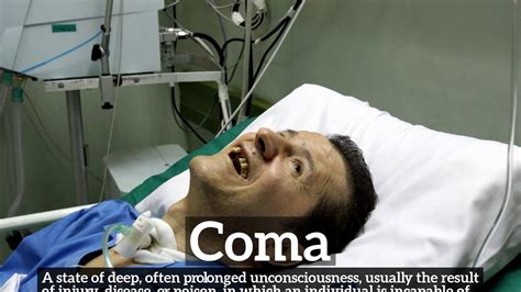 How Does Coma Look How To Say Coma In English What Is Coma Youtube