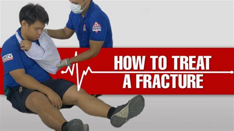 How To Give First Aid And Treat A Fracture Youtube