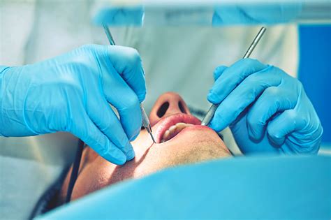 5 Common Oral Surgeries Doctor Espo