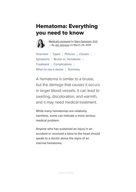 Solution Hematoma Overview Types Treatment And Pictures Studypool