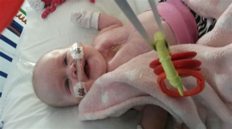 Baby Born With Heart Outside Body Is Progressing Well In Nottingham