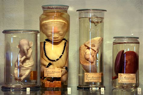 Museumboerhaave Specimenbybrugmans Medical Curiosities Creepy