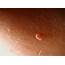 Skin Tags  Removal Pictures Causes Symptoms Treatment
