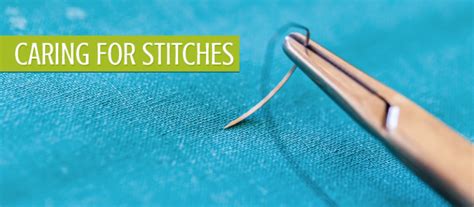 Care For Stitches Pediatric Urgent Care Of Northern Colorado