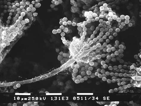 Free Picture Up Close Asexual Aspergillus Fungal Fruiting Body