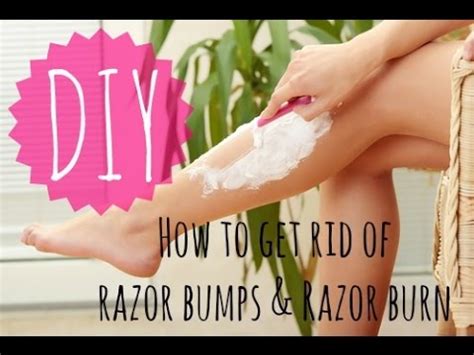How To Get Rid Of Razor Bumps And Razor Burn Diy Youtube