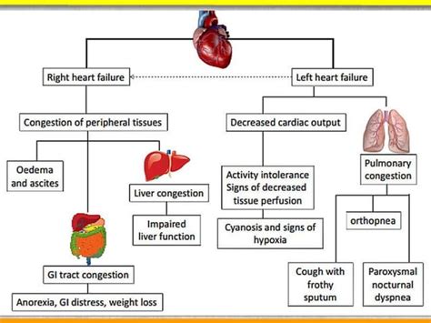 A Brief Synopsis Of Acute Decompensated Heart Failure Ppt