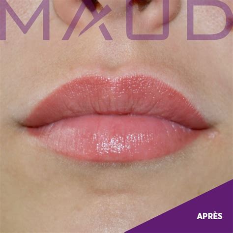 Maquillage Permanent Des L Vres Maud Dermo Esthetic