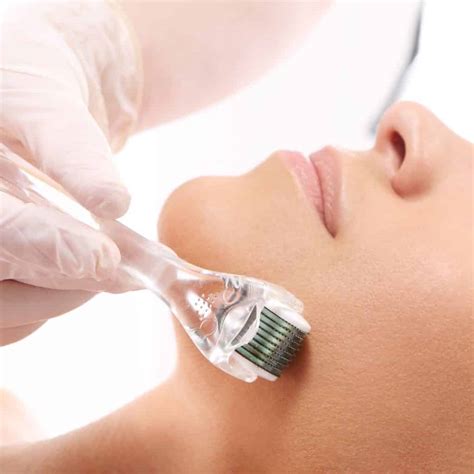Collagen Induction Therapy Spadental Group