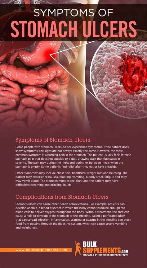 Stomach Ulcers Causes Symptoms Home Remedies And Treatment