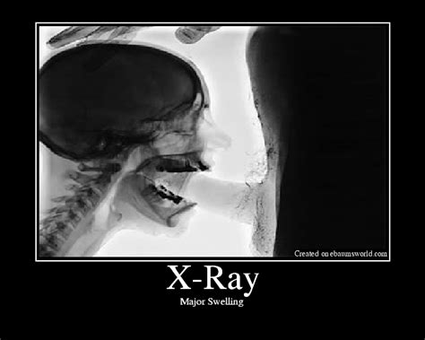 X Ray Picture Ebaums World