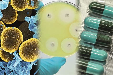 New Approaches To Overcoming Antimicrobial Resistance The