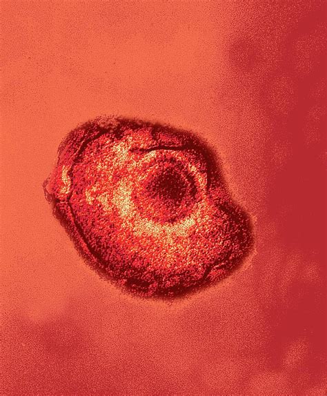 Varicella Zoster Virus Particle Photograph By Ami Imagesscience Photo