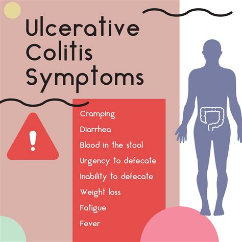 What Is Ulcerative Colitis Causes Symptoms Treatments The Amino