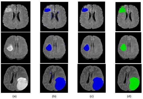 J Imaging Free Full Text Brain Tumor Segmentation Based On Deep