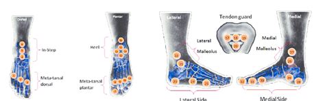 9 photos of the foot tendons and ligaments diagram. Sensors about foot, ankle and lower leg and tendon guard ...