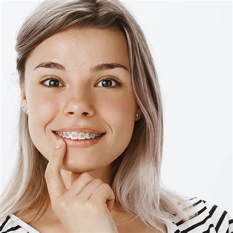 How Long Does It Take To Remove Fixed Braces Reverasite