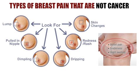 The lump might protrude from your breast, or you might notice it by feeling your breasts. Types Of Breast Pain That Are Not Cancer - What You Need ...