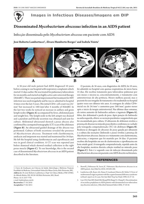 Pdf Disseminated Mycobacterium Abscessus Infection In An Aids Patient
