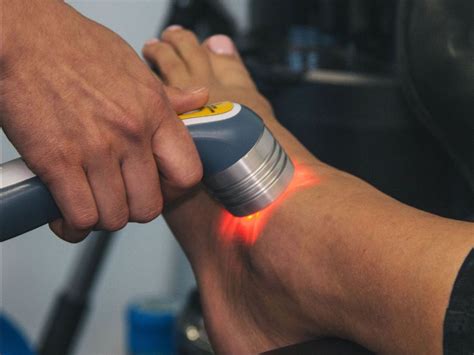 What Is Laser Therapy Allied Physiotherapy Health Group