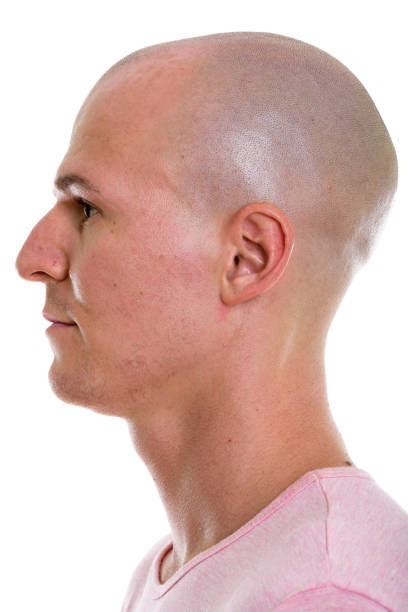 2000 Side View Of Bald Head Stock Photos Pictures And Royalty Free