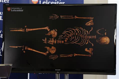 King Richard Iii Skeleton Found In Parking Lot Photo 30 Pictures