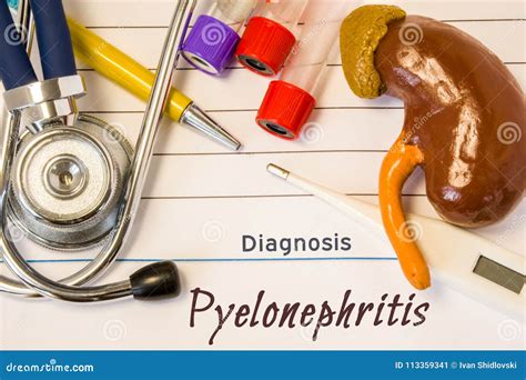 Diagnosis Pyelonephritis Photo Figure Of Kidney Lies Next To