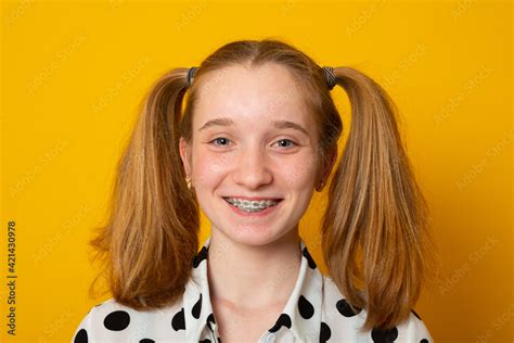 Cheerful Girl With A Two Ponytail Hairstyle Smiles With Braces On A Yellow Background Teenager