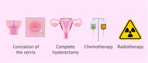 Therapeutic Options For Cervical Cancer
