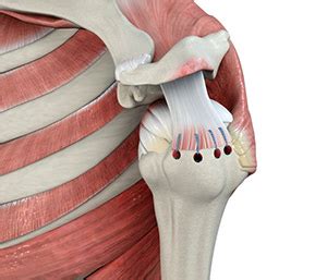 You can tear your rotator cuff in two ways as you get older, you get less blood to your rotator cuff area, which makes small tears hard to repair how your recovery goes will depend a lot on the size of the tear and how long your rotator cuff was torn. Arthroscopic Rotator Cuff Repair Chandler, AZ | Rotator ...