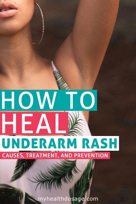 armpit rash causes how to heal and prevention in 2020 with images underarm rash armpit