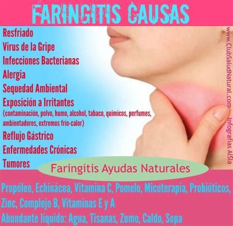 Remedios Naturales Para La Faringitis Síntomas Y Causas Club Salud