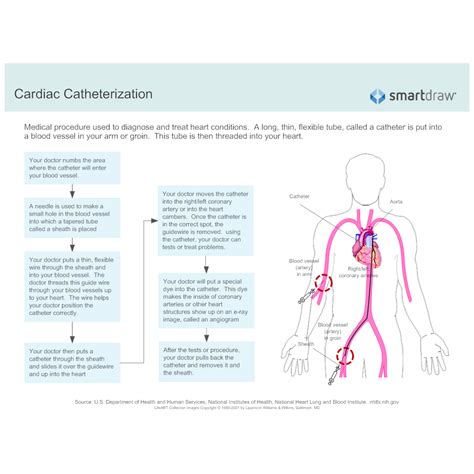 Cardiac Catheterization Procedure