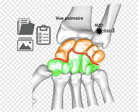 Thumb Ulnar Nerve Wrist Joint Human Anatomy Carpe Text Hand Png PNGEgg