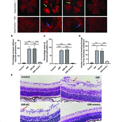 Overexpression Of Mir P Can Reduce The Degree Of Oir Retinal Download Scientific Diagram